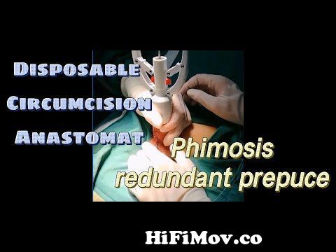 Phimostop: how to cure phimosis without circumcision surgery 