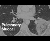 Thoracic Radiology