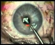 Corza Ophthalmology
