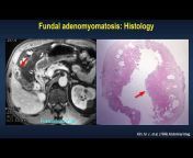 Stories of Abdominal Radiology Cases u0026 Topics