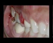 Atlanta Endodontics
