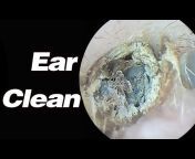 EAR CLEANING PRO