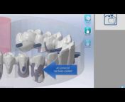 CIMsystem Dental