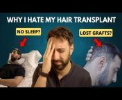 Post Hair Transplant Tips by Amit