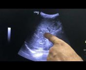Dr Jayesh Dabhi Ultrasound Training