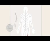 Boston Scientific: Chronic Pain and Spinal Cord Stimulation (SCS)