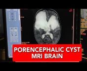 MRI u0026 CT Scan Tech