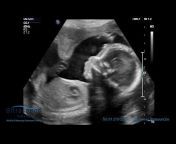 Ultrasound Ireland: Medical, Pregnancy Scans u0026 IVF Fertility Scans