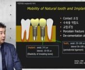 2020 MINI CHANNEL_PROSTHODONTICS & IMPLANT 01(SUNG, MOO GYUNG) from 2020 mini