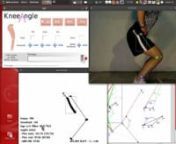 This video shows how KneeAngle manages finding of markers on skin. The video used as sample has really bad illumination conditions. Here KneeAngle shows it&#39;s capability to play with threshold to find the desired points.nnThe 1.6 version of KneeAngle has input by a clicking window named gui.nnData is exported to free statistics package R and two graphs are shown.nnAt first, a graph of knee abduction triangles problem is shown (done with Kig)nnNote the ABD+External rotation angle detection is not