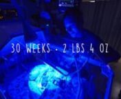 Our son Rowan was born at 30 weeks gestational age at 2 lbs 4 ounces due to my wife having severe preeclampsia. I made this video as a way to tell our story and to give other families with premature babies some hope. nnThe first couple weeks were very touch and go but fortunately his digestive system eventually matured enough to function. He was attached to a continuous positive airway pressure (CPAP) with added oxygen for most of our time in the NICU. He also required a feeding tube, IV PIC lin