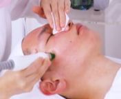 Hydrafacial Glowing Skin Before And After &#124; Hydra facial Full Operation Tutorial &#124; AF1318 Part IInnCheck the price: https://www.mychway.com/itm/1005285.htmln#hydrafacial #acne #mychwaynnThis is the must-have hydra facial machine that all estheticians &amp; massage therapist should have in their spa and salon. This video shows how to use this hydra facial machine 7in1 step by step.nnnHydrafacial treatment is not only good for skin clean, but also for acne removal, acne extraction, blackhead extra