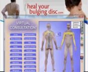 Visit http://www.healyourbulgingdisc.com for more information.nnThere are many bulging disc symptoms and herniated disc symptoms that you may be experiencing, but didn&#39;t know that they were related to the condition in your spine.The reason for this is because of the nerves that are affected with this type of condition.In this video, Dr. Ron Daulton, Jr. discusses the different symptoms you may experience, why they develop, and what you can do for relief.He also discusses why it is importan