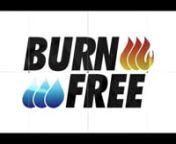 BurnFree Long Documentary Video Transcription:nnOver the last 20 years BurnFree has been working to revolutionize burn care. nnBurns are an incredibly common injury. Each year over 11.6 million people are treated for their burn injuries. These are not the common burns, but the severe burns that require medical attention. nnBurns are really one of the more painful injuries that we ever have. The main reason is because there are a lot of nerve endings in the skin. They&#39;re there to protect us from