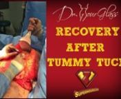 Recovery from a tummy tuck.nnHi, this is Dr. Hourglass, today we are going to talk about recovery after a tummy tuck. nnnRecovery after a tummy tuck requires you to be extremely compliant with the treatment. During your first week, including immediately after surgery, you should be able to walk around and drink fluids. This will decrease your risk of complications, including blood clots. In general, you need to take about two weeks off work. This does not mean you are going to be completely reco