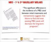 Dr. Rodrigo Cunha: Finding MB2 in Maxillary Molars from mb2