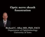 This is Richard Allen at the University of Iowa. This video demonstrates an optic nerve sheath fenestration in a patient with idiopathic intracranial hypertension.The approach here is the medial lid crease.A traction suture is placed partial thickness through the superior medial limbus with 7-0 vicryl suture to place the globe in infra and A-B duction.A 4-0 silk suture is then placed through the eyelid margin to provide traction.An incision is then made with the 15 blade at the eyelid cr