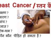 This video Provides the complete information in Hindi language about Breast cancer symptoms , breast pain,breast chemotherapy , breast self examination , stages of breast cancer in hindi, swelling in breast,breast swelling inHindi language स्तन कैंसर कारण , Breast Cancer कारण , स्तन कैंसर लक्षण , स्तन कैंसर रोक-थाम , ब्रेस्ट कैंसर or स्तन कैंसर Stages , ब्
