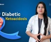 Learn Endocrinology with us! - Watch complete lecture on sqadia.com nhttps://www.sqadia.com/programs/diabetic-ketoacidosisnnDiabetic ketoacidosis (DKA) is a condition, where the ketones in the blood increase to a life-threatening level. This leads to many complications. nnDKA is mostly termed as a complication most prevalent in diabetes patients. Watch this Endocrinology lecture that discusses the underlying causes, pathogenesis, symptoms, diagnosis, and treatment of DKA. All this is discussed w