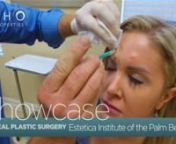 Excellent, high level plastic surgery!nnAgent Homaira Mangal takes us to Estetica Institute of the Palm Beaches in Palm Beach Gardens &amp; sits down with Greg DeLange, MD to find out the services offered...nnBoard Certified Plastic Surgeons specializing in high end surgeries...nnFace Lifts, Brow Lifts, Tummy Tucks, Breast Augmentation, Brazilian Butt Lifts, &amp; much more...nnNon-surgical procedures...nnBotox &amp; Fillers, Liquid Face Lifts, Lip Augmentation, Permanent Makeup, Eyelash Extensi