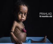 CreditsnnPrahlad (18 months old) - Photographs and Videos by Sanjit Das;nPrahlad (5 and a half years old)- Videos by Kartik Avatani;nnVideography and Editing - Kartik AvataninnAn assignment for Fight Hunger Foundation.nnwww.kartikavatani.in