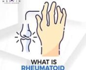 Rheumatoid arthritis, or RA, is an autoimmune and inflammatory disease, which means that your immune system ������� ������� ����� �� ���� ���� �� �������, ������� ������������ (painful swelling) in the affected parts of the body. RA mainly attacks the joints, usually many joints at once.nInclusion Criterian* Must have Diagnosis of Rheumatoid Arthritisn* Must have tried Methotrexate f