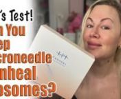 SUBSCRIBE!nI LOVE Exosomes, I have used them many times and they are great when placed deeper into the skin to heal and repair! But let&#39;s try microneedling them :) Microneeedling exosomes is a popular treatment in US clinics so let&#39;s give it a test!nnMore information on Hanheal Exosomes here: https://www.acecosm.com/categories/skin-booster/hanheal_exosomen*** Code Jessica10 saves you moneynnGet your Dr.Pen M8 here: https://www.acecosm.com/categories/devices/dr_pen_m8n*** Code Jessica10 saves you