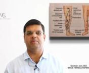 Watch the video to get access to an informative, &amp; detailed guide on venous ulcers including their symptoms, causes, treatments &amp; preventive care at home. nnVenous ulcers, also referred to as stasis, insufficiency or varicose ulcer is a wound or sore on the leg that occurs when the veins in the leg are not capable of sending blood back to the heart due to the malfunctioning venous valves. This is known as venous insufficiency that causes increased pressure at the end of the limb and make