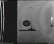 The video shows the MRI of a prosthetic tissue heart valve without VueKlar&#39;s MR-Enhancement. The heart valve is part of a circulation model that causes the valve to open and close. Due to the MR image artifacts caused by the valve stent, the valve leaflets cannot be seen. The images are made with a real time sequence in a GE Signa 1.5T HDx.
