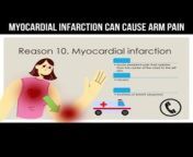 Myocardial infarction can cause arm pain #myocardialinfarction #armpain