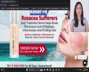 #RosaceaReliefSerum #RosaceaReliefSerumReviews #RosaceaReliefSerumPrice&#60;br/&#62;&#60;br/&#62;***official website link [https://bit.ly/Rosacea-Price]****&#60;br/&#62;&#60;br/&#62;Welcome to our YouTube channel! Discover the amazing benefits of our Rosacea Relief Serum through this in-depth review. If you&#39;re looking for information on RosaceaReliefSerum, its reviews, price, and how to order it online, you&#39;ve come to the right place.&#60;br/&#62;&#60;br/&#62; RosaceaReliefSerum Overview&#60;br/&#62;Uncover the secrets behind RosaceaReliefSerum and learn how it can effectively address the challenges of rosacea-prone skin. Our comprehensive review will provide you with all the details you need to make an informed decision.&#60;br/&#62;&#60;br/&#62;⭐ RosaceaReliefSerum Reviews&#60;br/&#62;Listen to real testimonials and experiences from users who have incorporated RosaceaReliefSerum into their skincare routine. Discover how this serum has made a positive impact on their skin and boosted their confidence.&#60;br/&#62;&#60;br/&#62; RosaceaReliefSerum Price and Deals&#60;br/&#62;Get insights into the pricing of RosaceaReliefSerum and stay informed about the latest deals and discounts available. We&#39;ll share valuable information on how you can save on your purchase.&#60;br/&#62;&#60;br/&#62; How to Buy RosaceaReliefSerum&#60;br/&#62;If you&#39;re ready to experience the benefits of RosaceaReliefSerum for yourself, we&#39;ll guide you through the easy and secure online ordering process. Learn where to buy it and get started on your journey to healthier, more radiant skin.&#60;br/&#62;&#60;br/&#62; RosaceaReliefSerum On Sale&#60;br/&#62;Stay tuned for exclusive information on current promotions and sales. Don&#39;t miss out on the opportunity to grab RosaceaReliefSerum at a special discounted price.&#60;br/&#62;&#60;br/&#62; RosaceaReliefSerum Discount Code and Coupons&#60;br/&#62;Unlock additional savings with our exclusive discount codes and coupons for RosaceaReliefSerum. We&#39;ll share the codes you need to enjoy extra benefits when making your purchase.&#60;br/&#62;&#60;br/&#62;Join us on this skincare journey as we explore the wonders of RosaceaReliefSerum. Subscribe to our channel for more skincare tips, reviews, and exclusive offers. Elevate your skincare routine with RosaceaReliefSerum today! ✨ #RosaceaReliefSerum #Skincare #BeautyCare #SkinLove #HealthySkin&#92;
